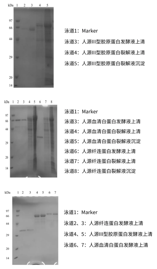 Human Recombinant Protein Expression Cases